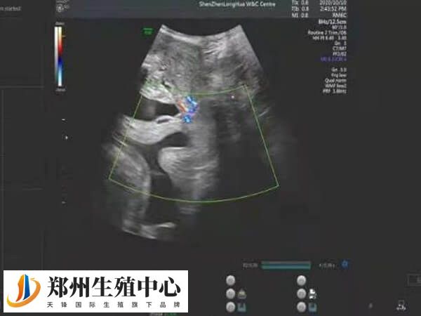 怀孕9周时试管婴儿的胎儿已经相对稳定