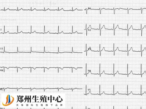 窦心率不齐可以治愈