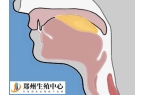 会厌囊肿手术后能不能怀孕