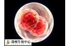 多囊做试管婴儿好还是促排好